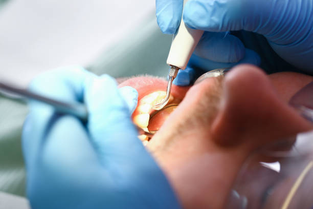 Dentist for Dental Trauma in TX